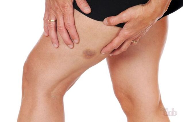 zain bat lehertzen bada