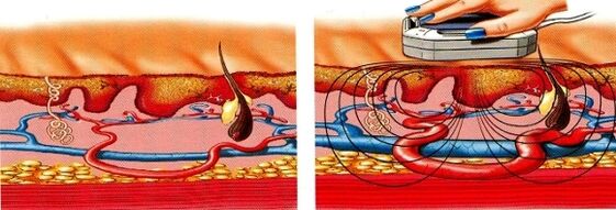 zure hankak moteltzen badira